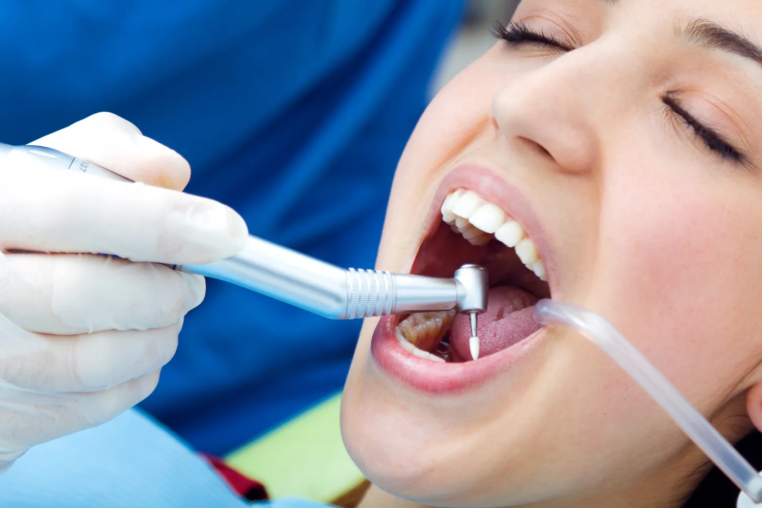 Cita de primera vez con profilaxis dental